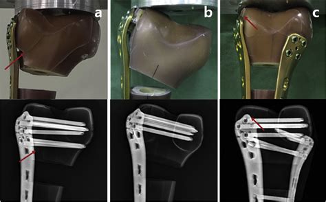 biomechanics testing machine for knee bending|Biomechanical testing of distal femur osteotomy plate .